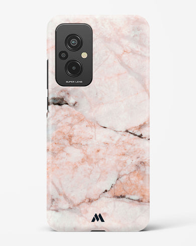 White Rose Marble Hard Case Phone Cover (Xiaomi)