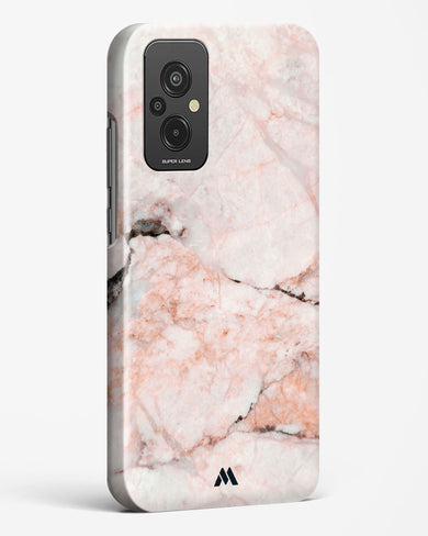 White Rose Marble Hard Case Phone Cover (Xiaomi)