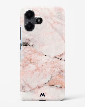 White Rose Marble Hard Case Phone Cover (Xiaomi)