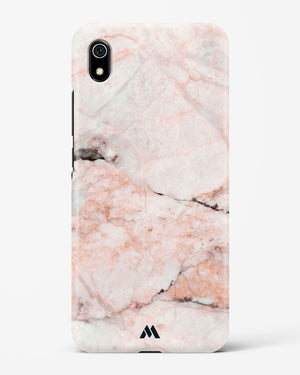 White Rose Marble Hard Case Phone Cover-(Xiaomi)