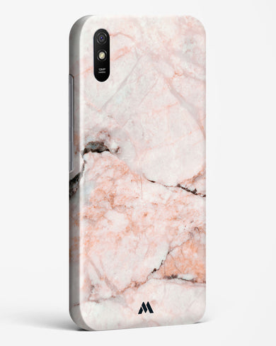 White Rose Marble Hard Case Phone Cover-(Xiaomi)