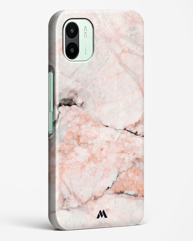 White Rose Marble Hard Case Phone Cover (Xiaomi)