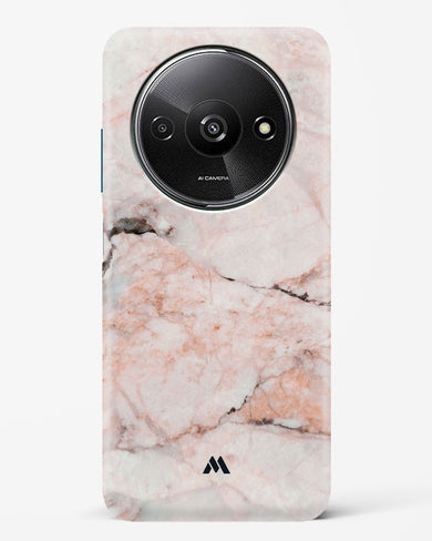 White Rose Marble Hard Case Phone Cover (Xiaomi)