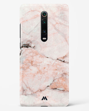 White Rose Marble Hard Case Phone Cover (Xiaomi)