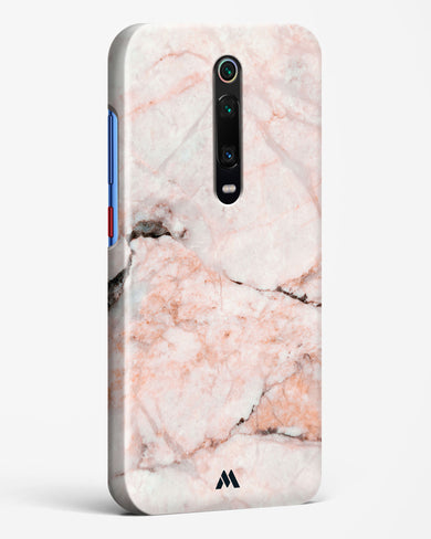 White Rose Marble Hard Case Phone Cover (Xiaomi)