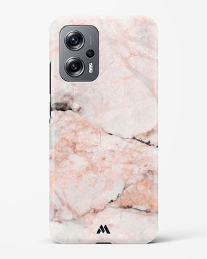 White Rose Marble Hard Case Phone Cover (Xiaomi)