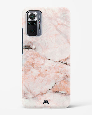 White Rose Marble Hard Case Phone Cover (Xiaomi)