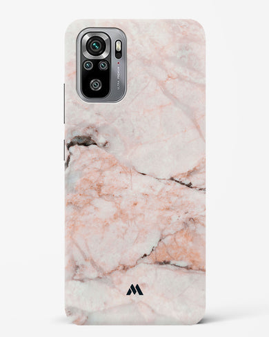 White Rose Marble Hard Case Phone Cover-(Xiaomi)