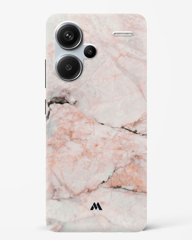 White Rose Marble Hard Case Phone Cover (Xiaomi)