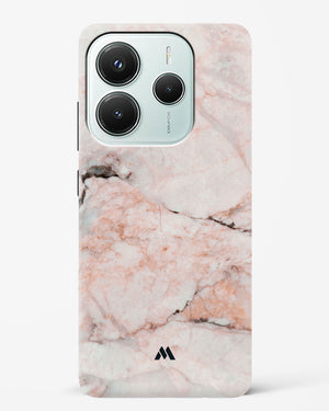 White Rose Marble Hard Case Phone Cover (Xiaomi)