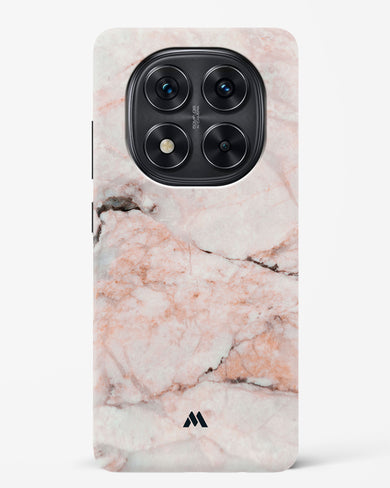 White Rose Marble Hard Case Phone Cover (Xiaomi)