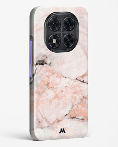 White Rose Marble Hard Case Phone Cover (Xiaomi)