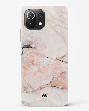 White Rose Marble Hard Case Phone Cover-(Xiaomi)