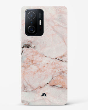 White Rose Marble Hard Case Phone Cover-(Xiaomi)
