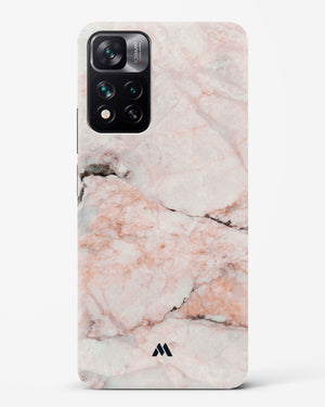 White Rose Marble Hard Case Phone Cover-(Xiaomi)