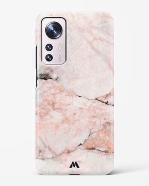 White Rose Marble Hard Case Phone Cover-(Xiaomi)