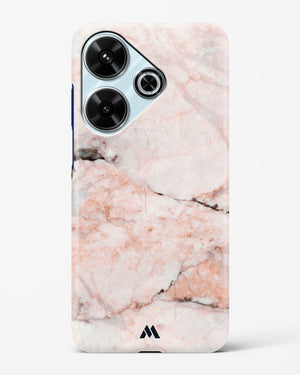 White Rose Marble Hard Case Phone Cover (Xiaomi)