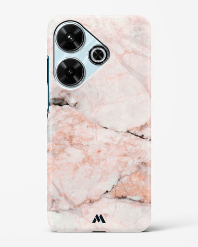 White Rose Marble Hard Case Phone Cover (Xiaomi)
