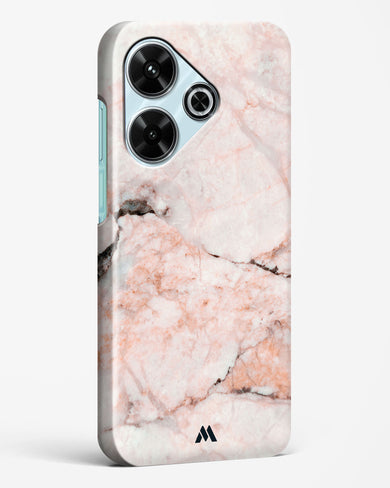 White Rose Marble Hard Case Phone Cover (Xiaomi)