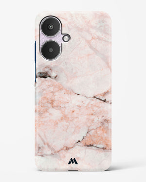 White Rose Marble Hard Case Phone Cover (Xiaomi)