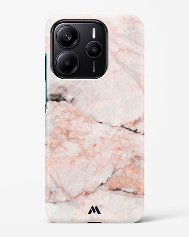 White Rose Marble Hard Case Phone Cover (Xiaomi)