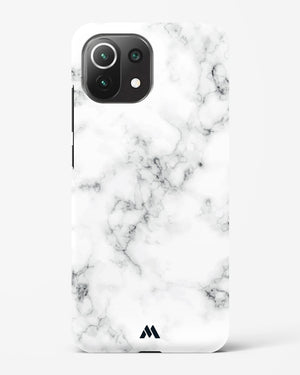 Bleached Bone Marble Hard Case Phone Cover (Xiaomi)