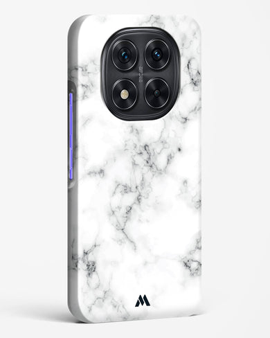 Bleached Bone Marble Hard Case Phone Cover (Xiaomi)