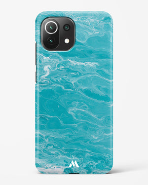 Clearwater Revival on Marble Hard Case Phone Cover (Xiaomi)