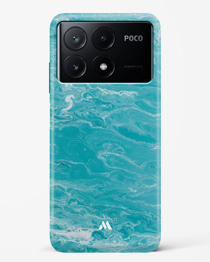 Clearwater Revival on Marble Hard Case Phone Cover (Xiaomi)