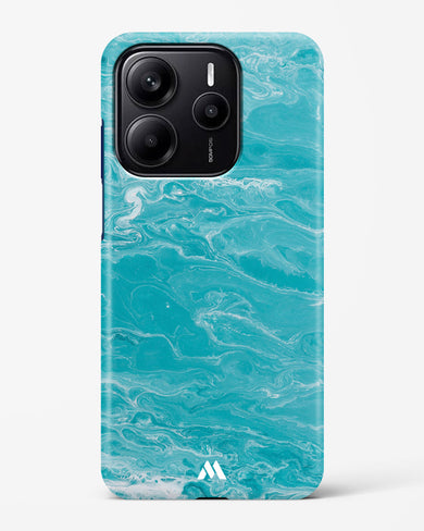 Clearwater Revival on Marble Hard Case Phone Cover (Xiaomi)