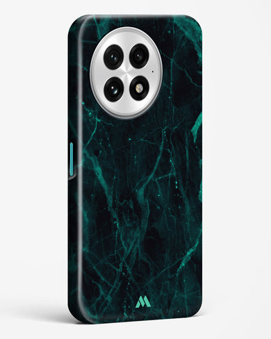 Creative Harmony Marble Hard Case Phone Cover (OnePlus)