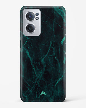 Creative Harmony Marble Hard Case Phone Cover (OnePlus)