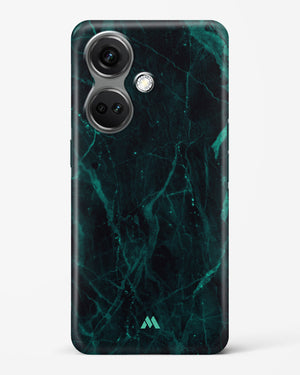 Creative Harmony Marble Hard Case Phone Cover (OnePlus)