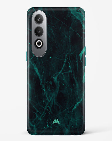 Creative Harmony Marble Hard Case Phone Cover (OnePlus)