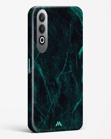 Creative Harmony Marble Hard Case Phone Cover (OnePlus)