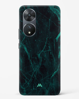 Creative Harmony Marble Hard Case Phone Cover (Vivo)