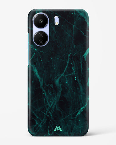Creative Harmony Marble Hard Case Phone Cover (Xiaomi)