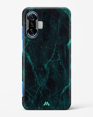 Creative Harmony Marble Hard Case Phone Cover (Xiaomi)