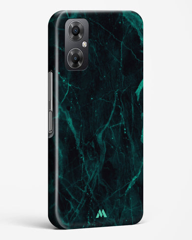 Creative Harmony Marble Hard Case Phone Cover-(Xiaomi)