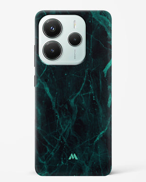 Creative Harmony Marble Hard Case Phone Cover (Xiaomi)