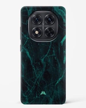 Creative Harmony Marble Hard Case Phone Cover (Xiaomi)