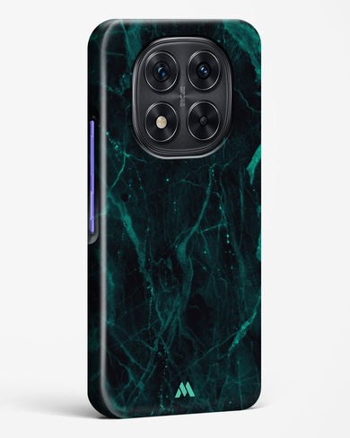 Creative Harmony Marble Hard Case Phone Cover (Xiaomi)