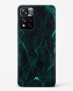 Creative Harmony Marble Hard Case Phone Cover (Xiaomi)