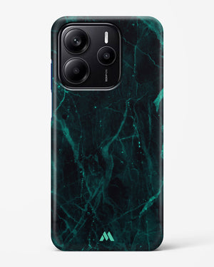 Creative Harmony Marble Hard Case Phone Cover (Xiaomi)