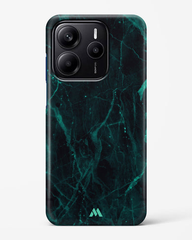 Creative Harmony Marble Hard Case Phone Cover (Xiaomi)