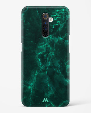 Olive Riddle Marble Hard Case Phone Cover (Realme)