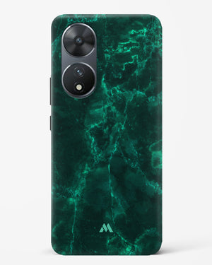 Olive Riddle Marble Hard Case Phone Cover (Vivo)
