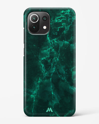 Olive Riddle Marble Hard Case Phone Cover-(Xiaomi)