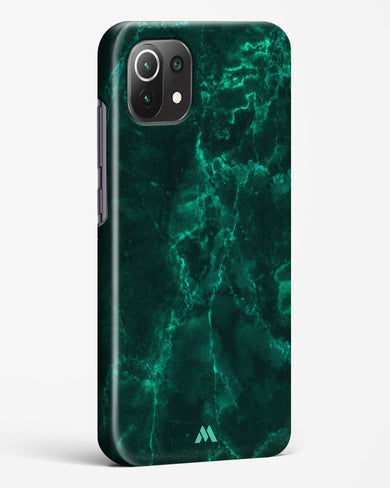 Olive Riddle Marble Hard Case Phone Cover-(Xiaomi)