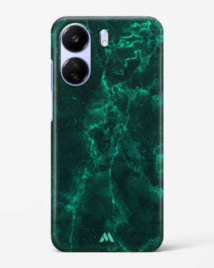 Olive Riddle Marble Hard Case Phone Cover (Xiaomi)